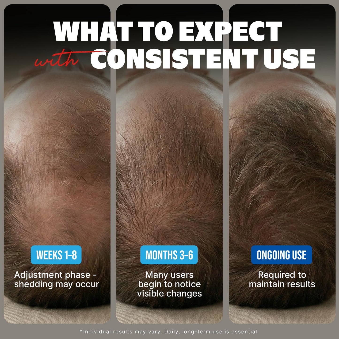 Kirkland Minoxidil Líquido para Hombres (Suministro para 6 Meses)